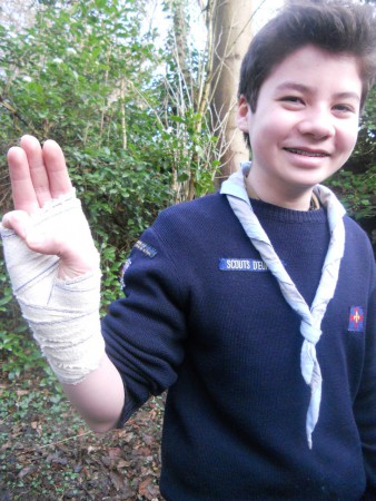 Maxime salut avec le bandage que Vianney à fait